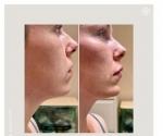 How should your skin be cared for in 2022? 